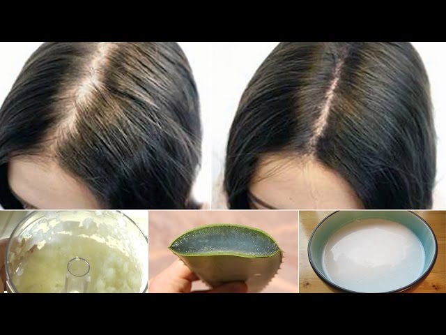 remedios caseros para el tratamiento y prevención de la caída del cabello